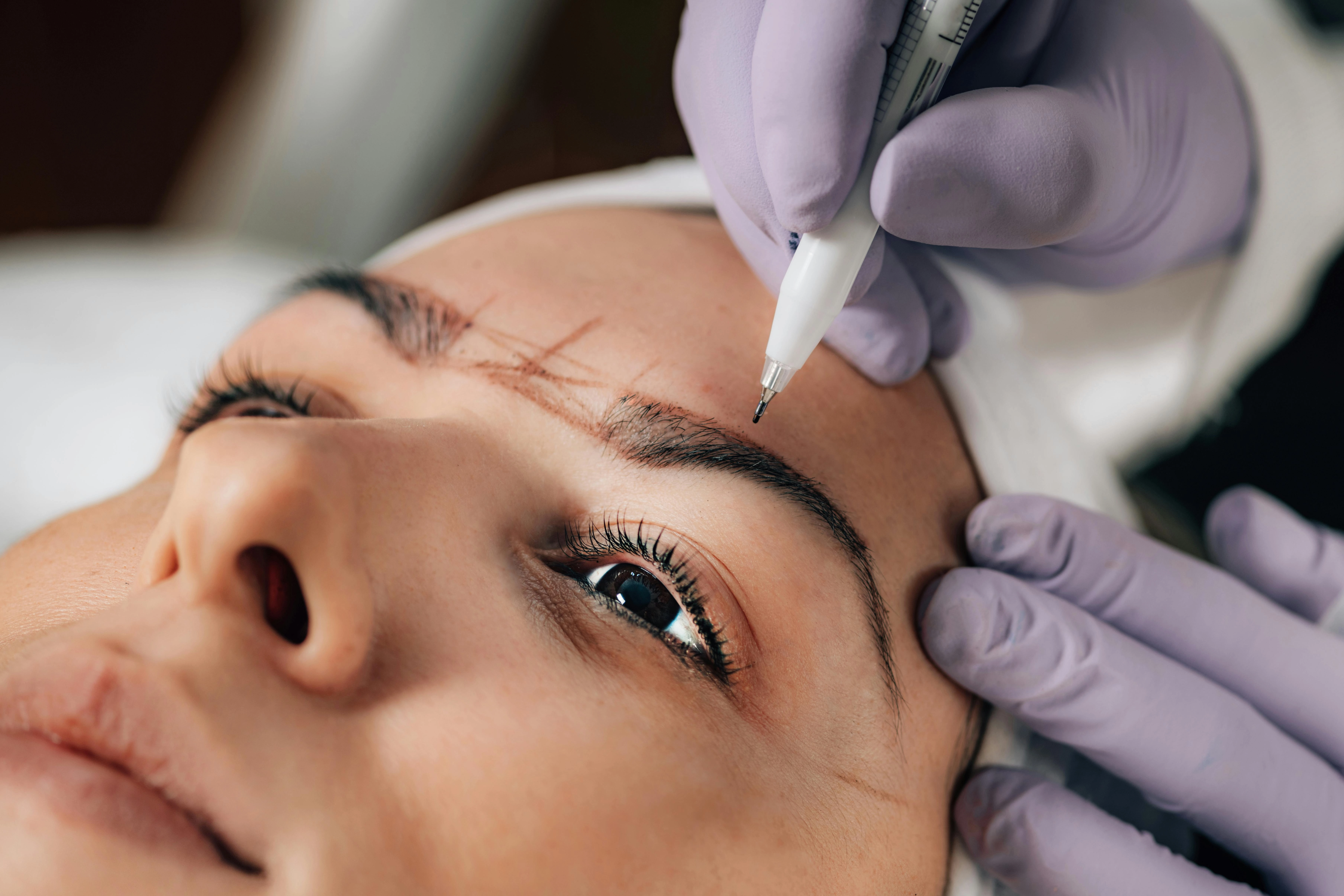 	Eyebrow Transplant