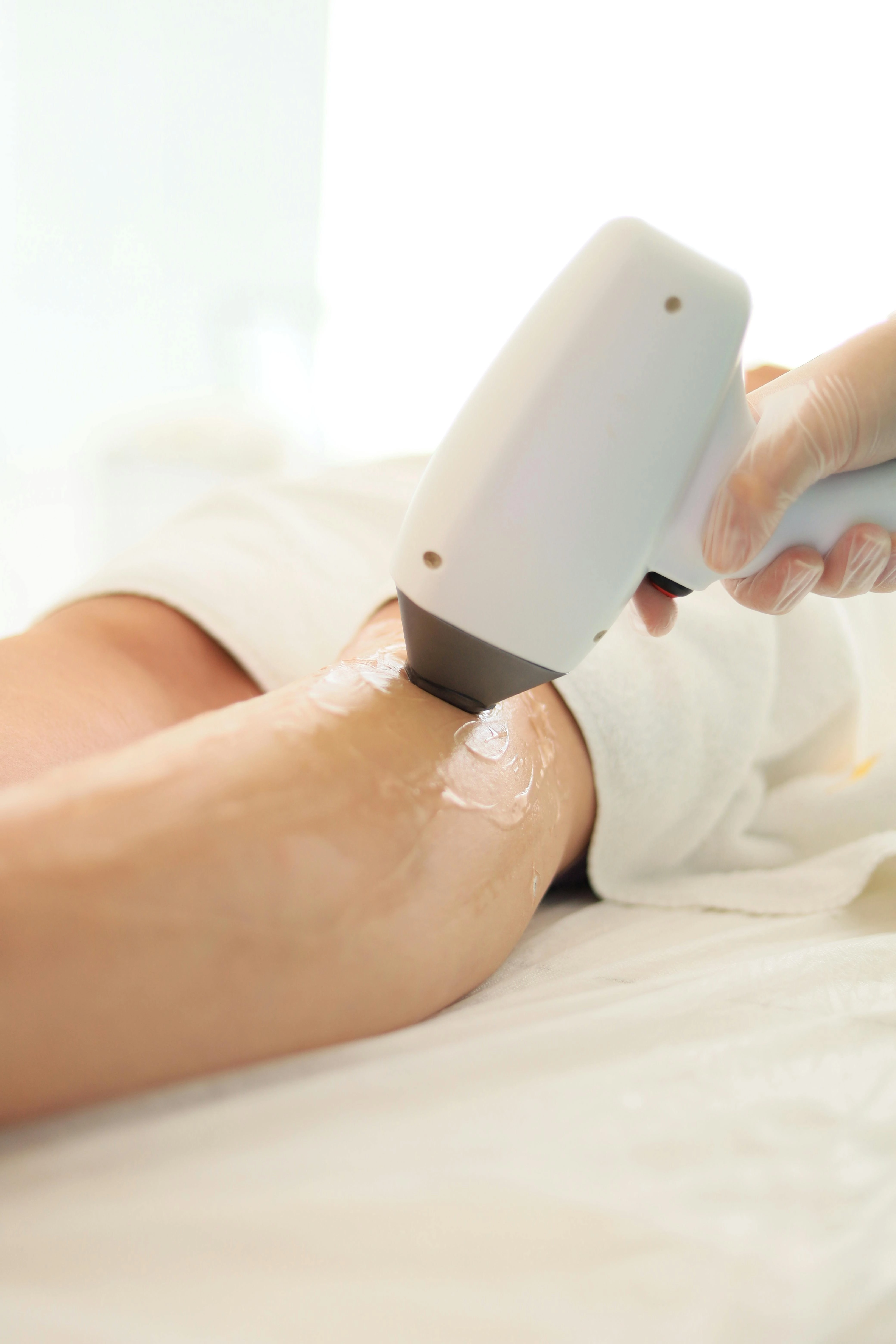 	Laser hair Removal