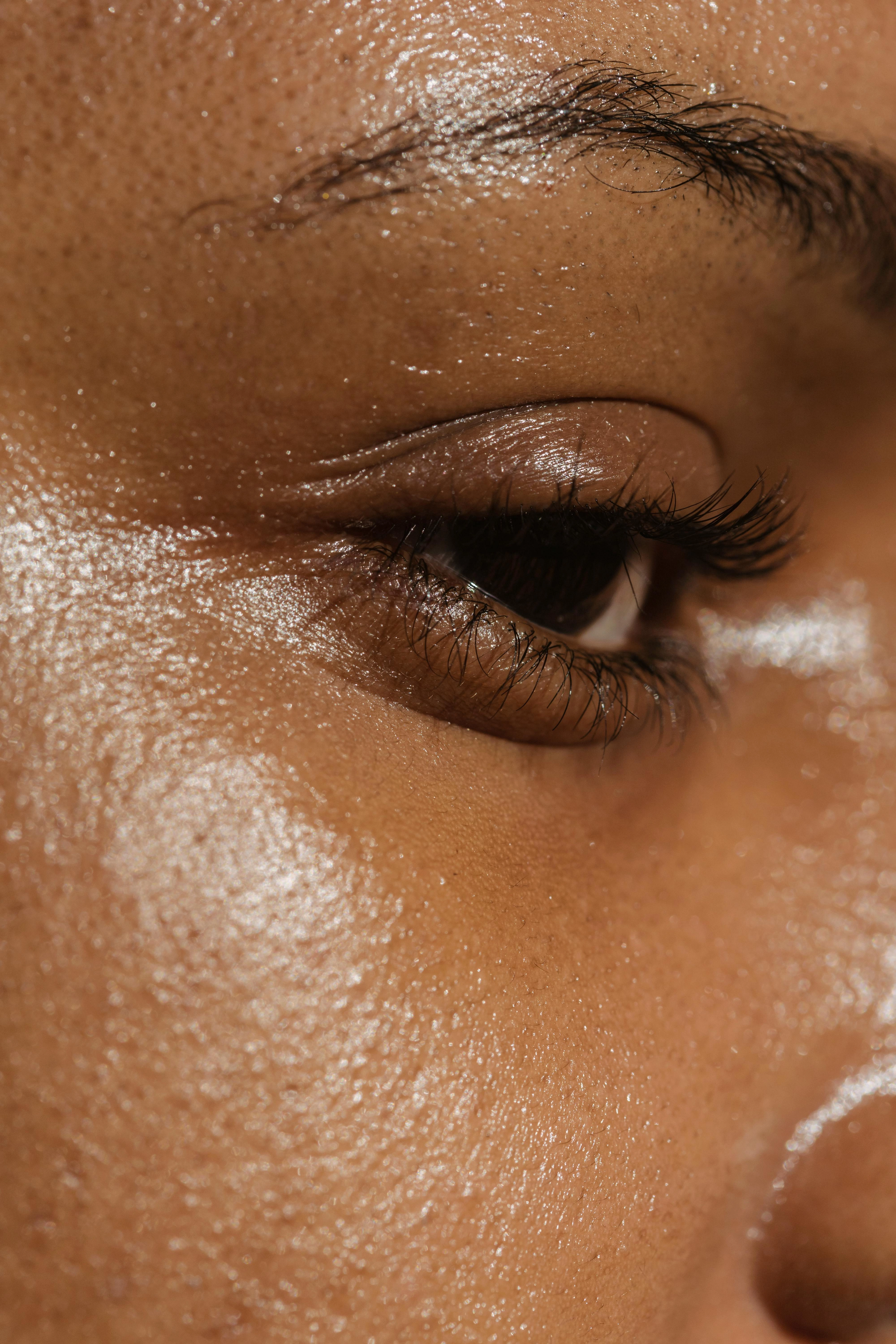 Open Pores & Oily Skin