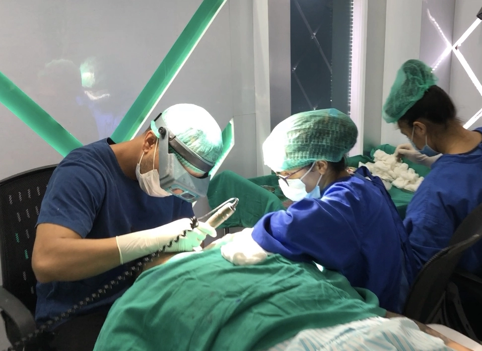 Rhinoplasty